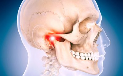 Causas de la Articulación temporomandibular