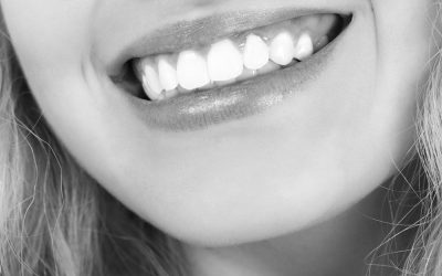 Blanquear los dientes: 7 motivos para hacerlo