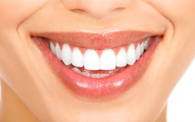 Manchas blancas en los dientes: Causas