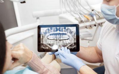 Cuidado de los implantes dentales: Consejos y trucos