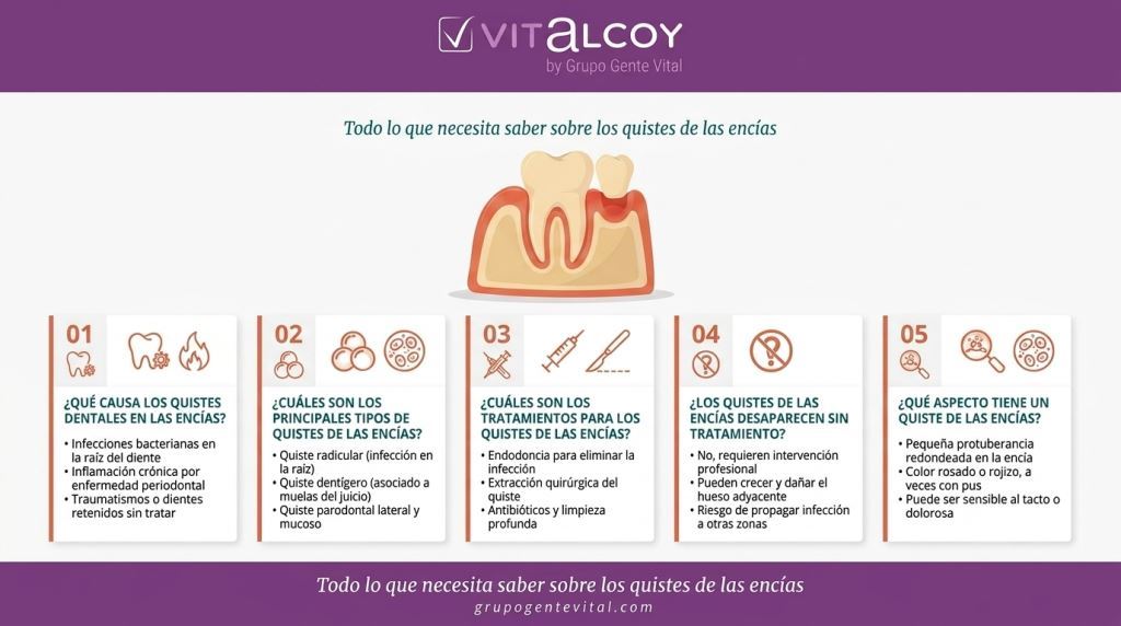 Tratamiento quiste en las encias Clínica dental Vitalcoy