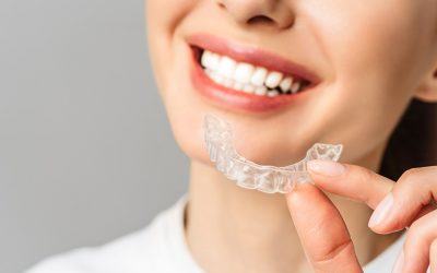 ¿Qué son los accesorios Invisalign y cómo mejoran el tratamiento de ortodoncia?