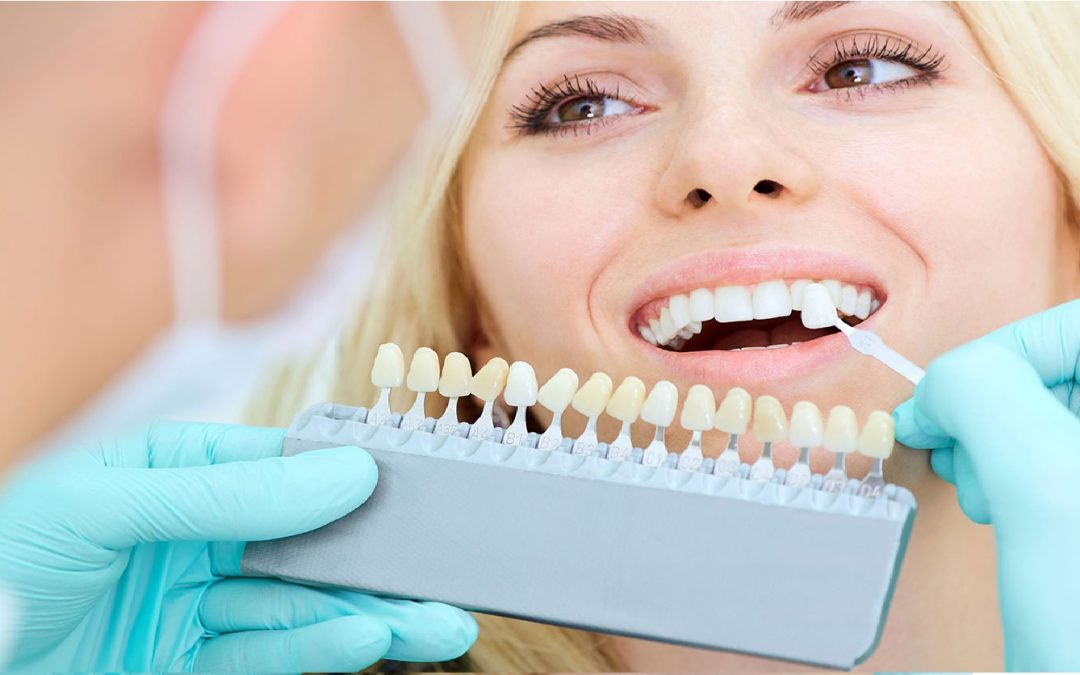 Prótesis dental precio
