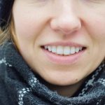 los Implantes Dentales están Transformando Sonrisas
