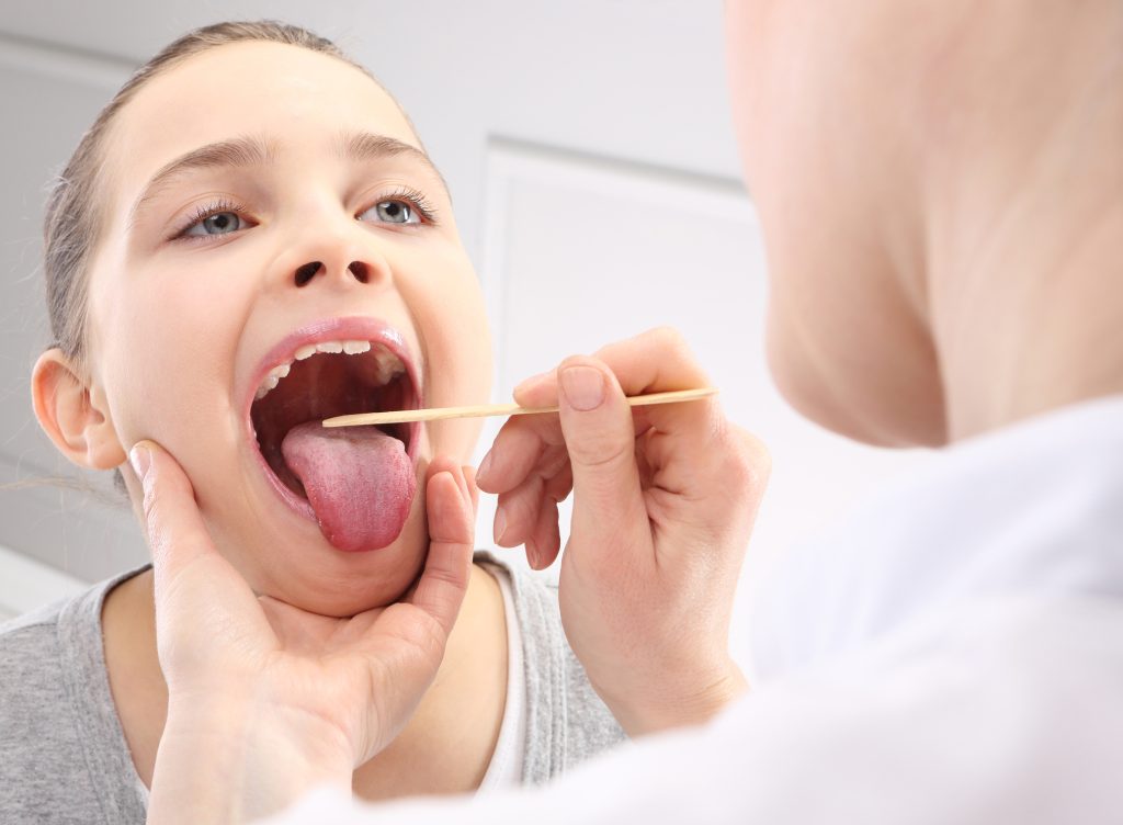Cómo prevenir los cálculos amigdalinos